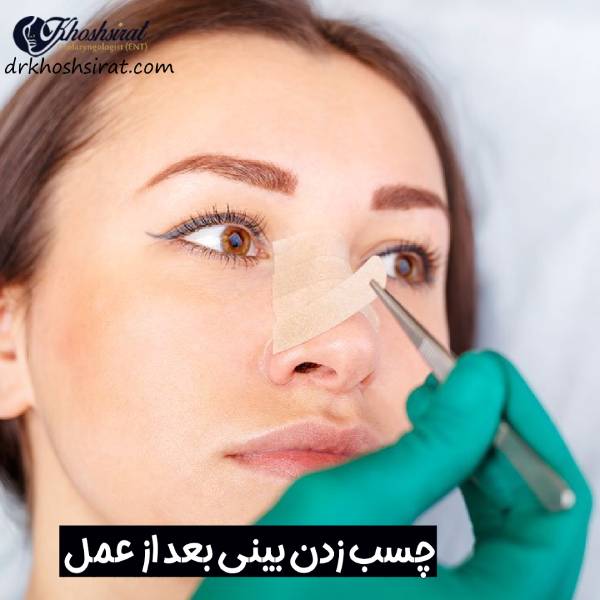 نحوه چسب زدن بینی بعد از رینوپلاستی