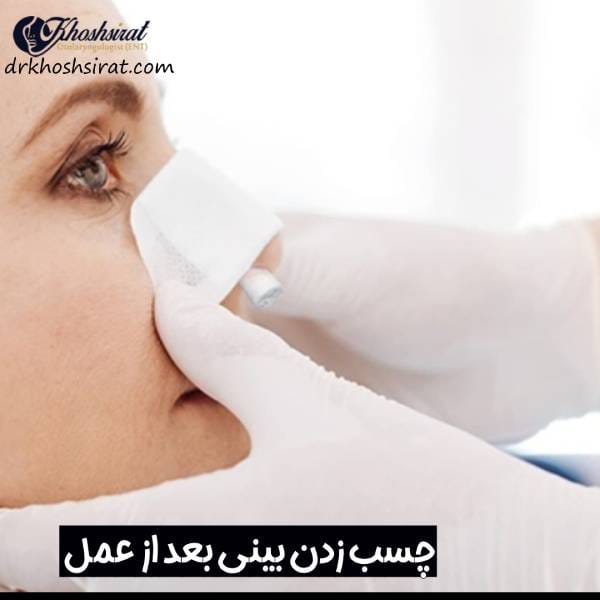 چسب زدن بینی بعد از عمل