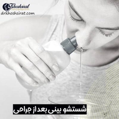 شستشوی بینی بعد از عمل