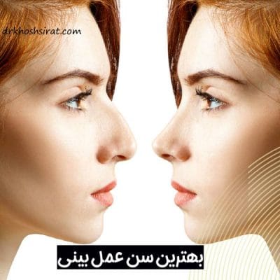 بهترین سن عمل بینی