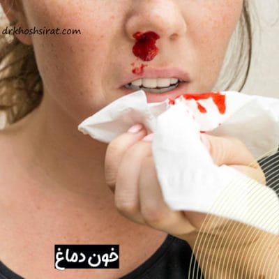 خون دماغ