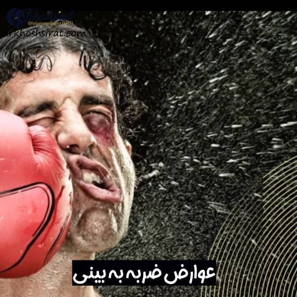 عوارض ضربه به بینی