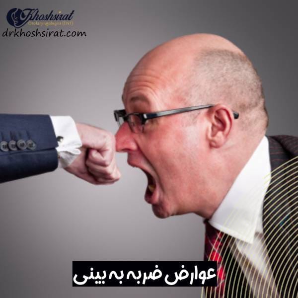 ضربه خوردن به بینی