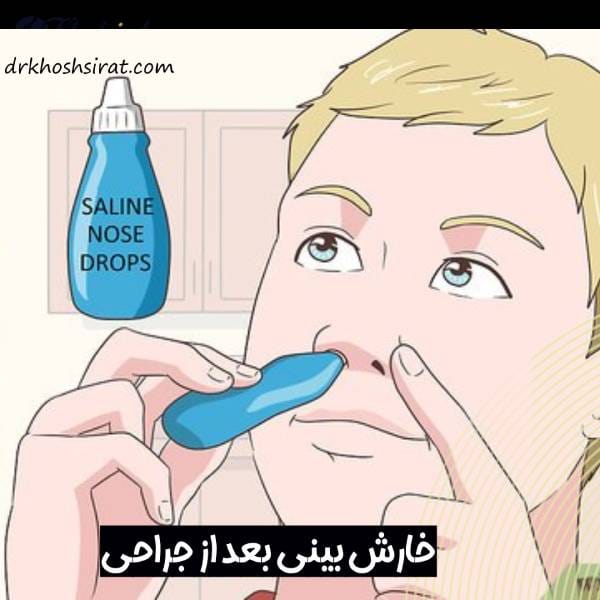 خارش بینی بعد از جراحی
