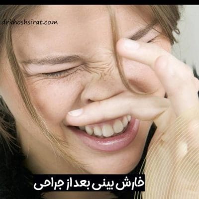 خارش بینی بعد از عمل