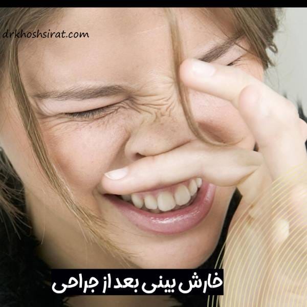 خارش بینی بعد از عمل