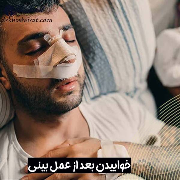 خوابیدن بعد از جراحی بینی
