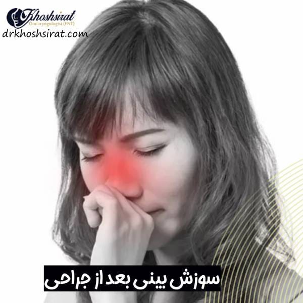 سوزش بینی بعد از جراحی