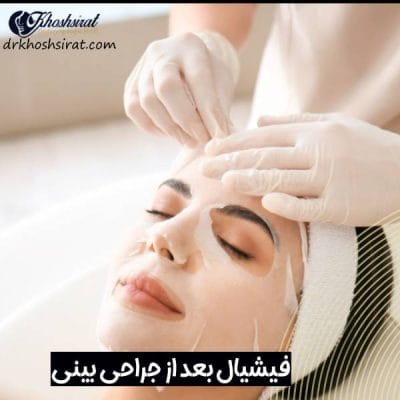 فیشیال بعد از جراحی بینی