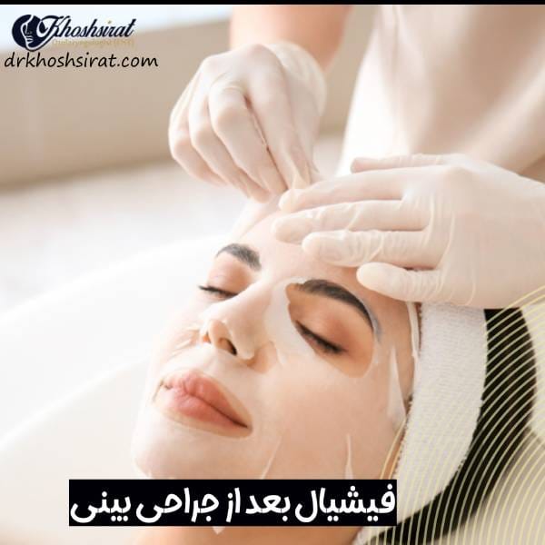 فیشیال بعد از جراحی بینی