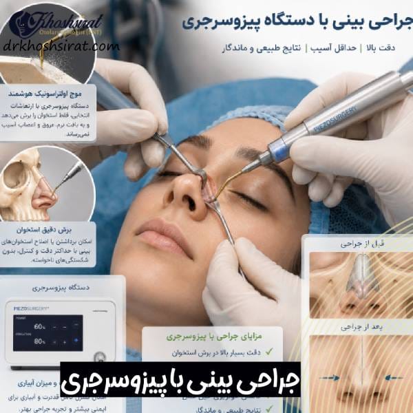 عمل بینی با دستگاه پیزوسرجری