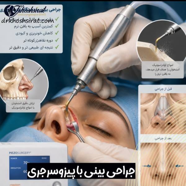 جراحی بینی با پیزوسرجری