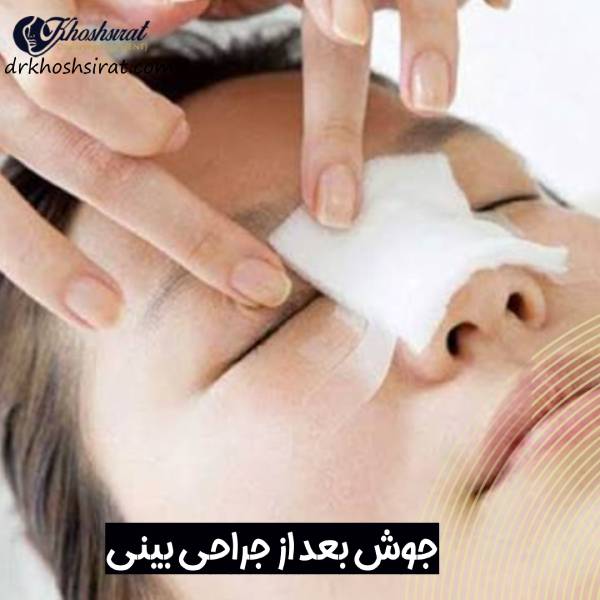 جوش زدن بعد از جراحی بینی