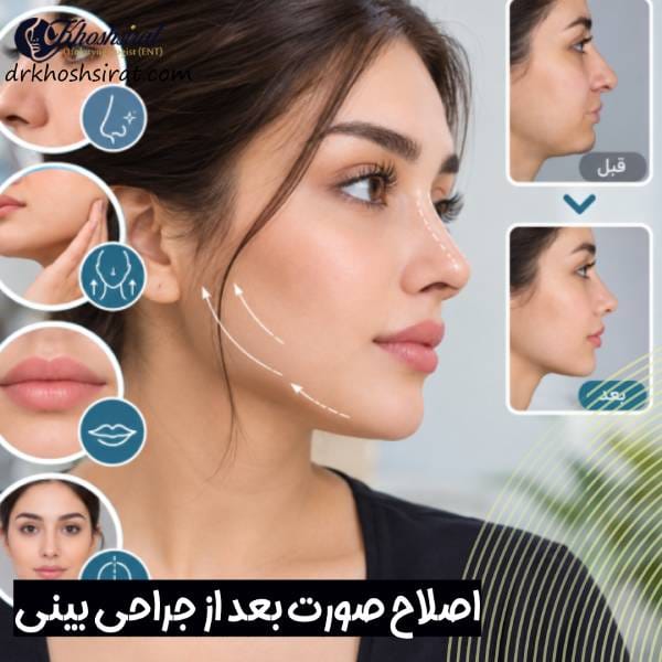 اصلاح صورت بعد از جراحی بینی