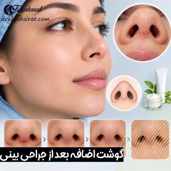 رد اسکار و گوشت اضافه بعد از عمل بینی